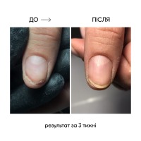 Thumbnails