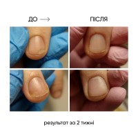 Thumbnails