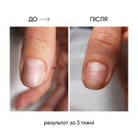 Thumbnails