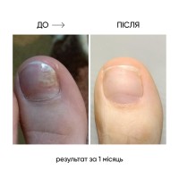 Thumbnails