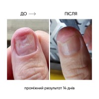 Thumbnails